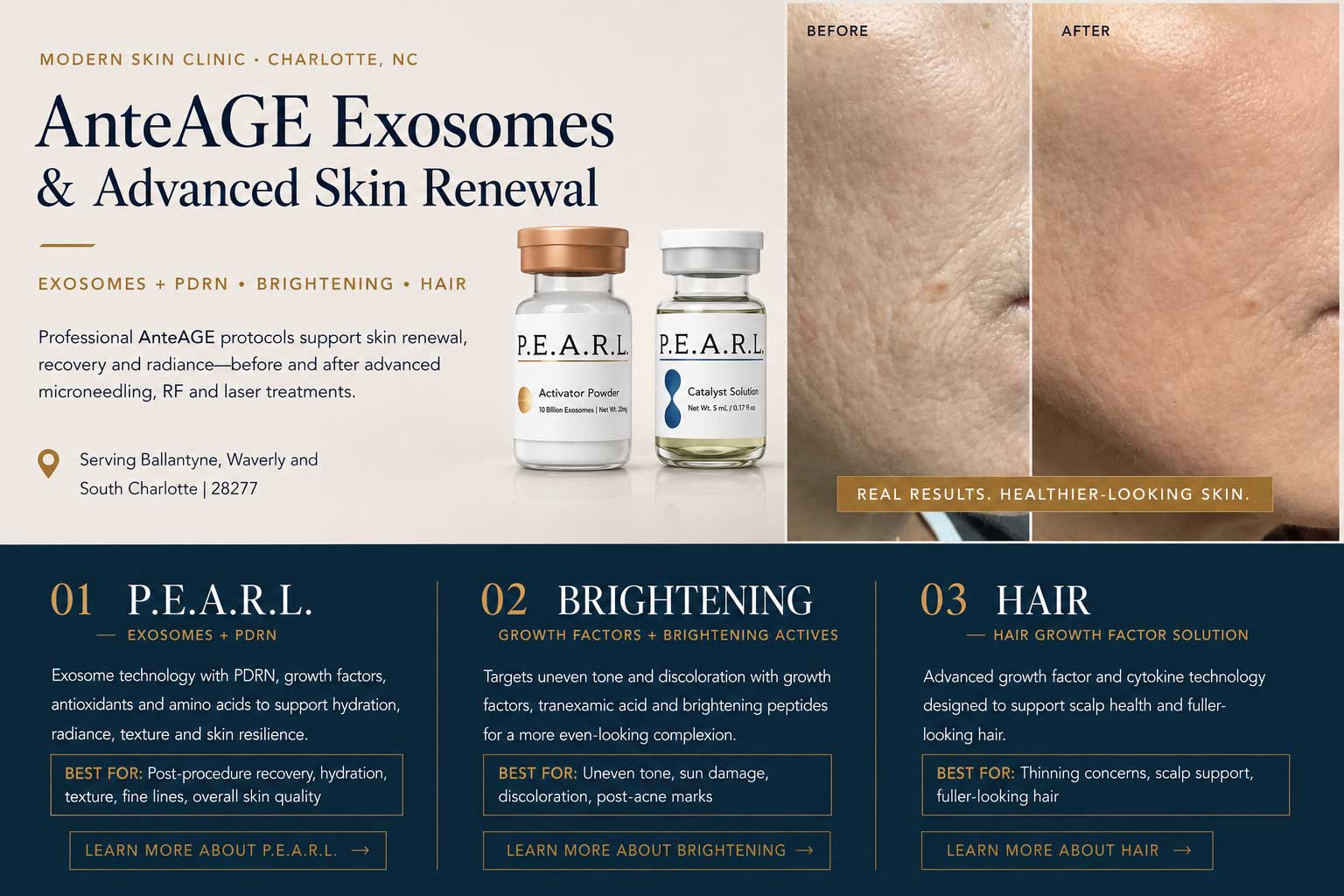 AnteAGE P.E.A.R.L. exosomes and PDRN in Charlotte NC with before and after skin results